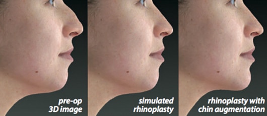 Treatment Comparison