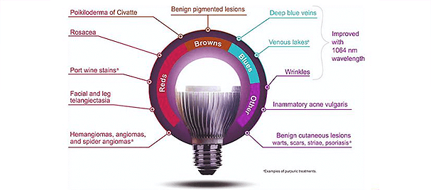 Vbeam Prima-features