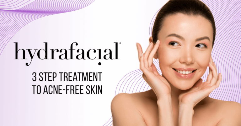 Hydrafacial’s 3-Step Treatment to Acne-Free Skin