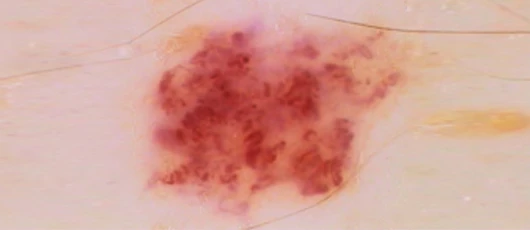 10x Magnification