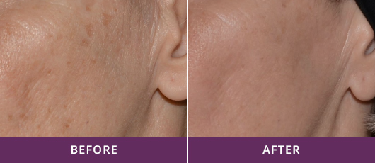 SKIN REVITALIZATION & YOUTHFUL GLOW
