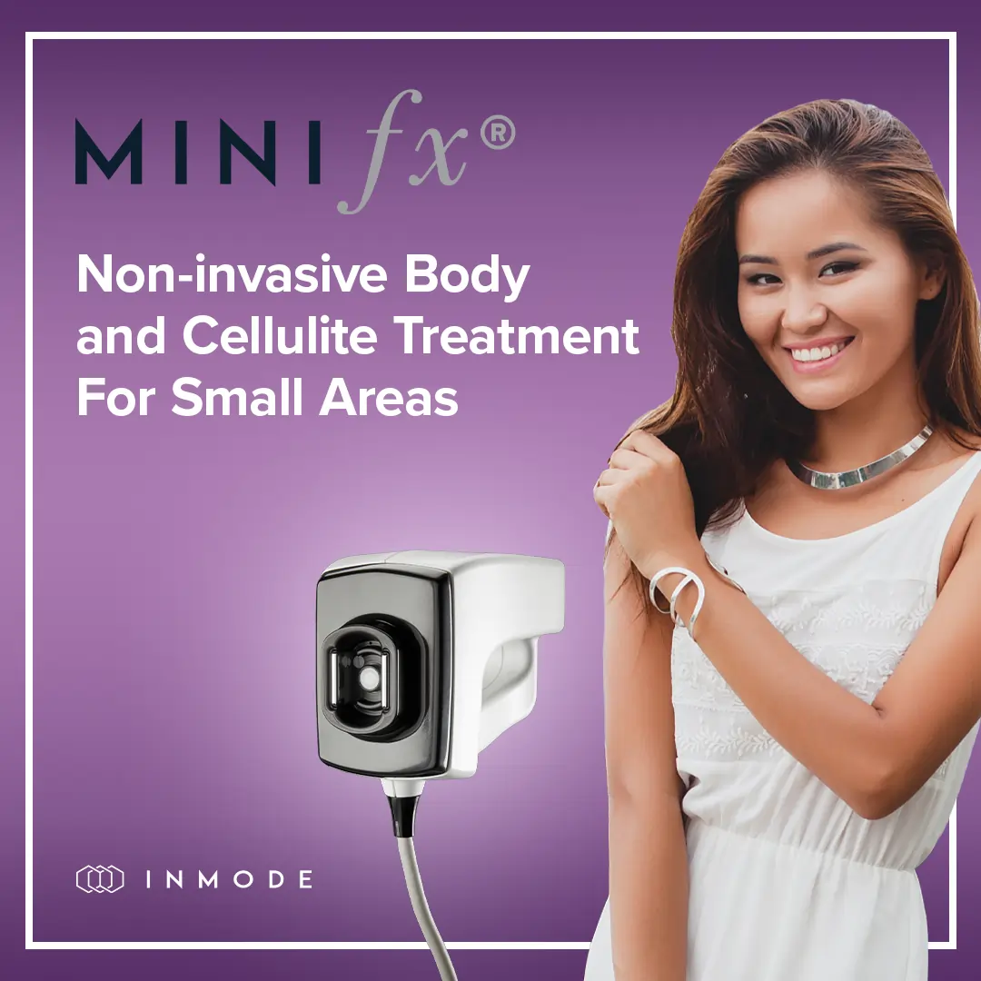 Mini FX Featured Page Cover Image 1×1