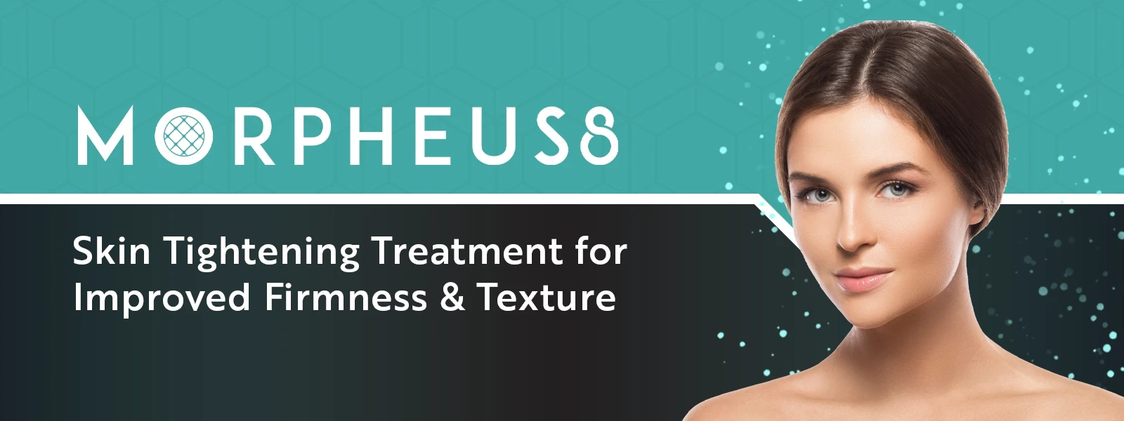 Morpheus8 Media Buzz Banner